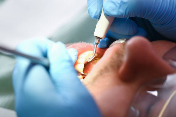 Best Emergency Gum Treatment in Lawton, MI