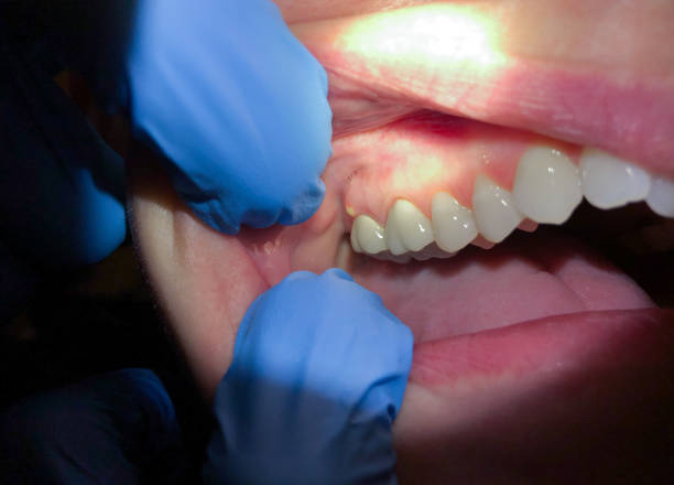 Best Weekend Emergency Dentist in Lawton, MI